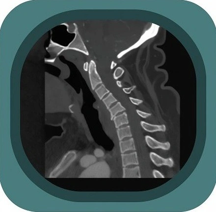 CT c spine anatomy icon